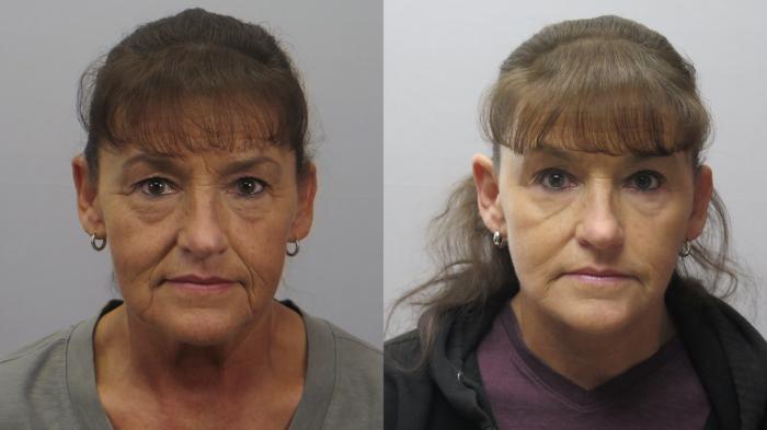 Facelift Case 1630 Before & After Front | Paramus, New Jersey | Parker Center for Plastic Surgery
