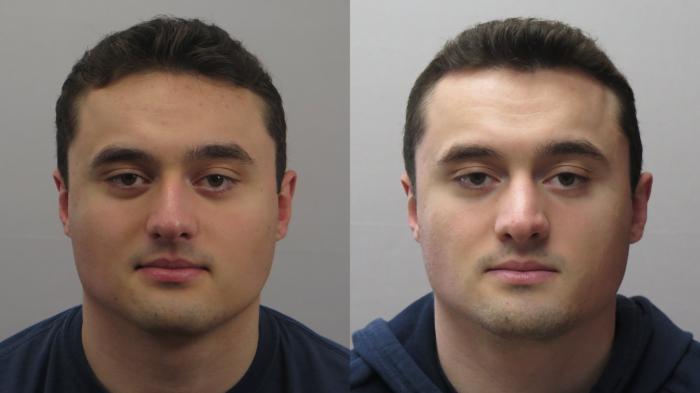 Rhinoplasty Case 1643 Before & After Front | Paramus, New Jersey | Parker Center for Plastic Surgery